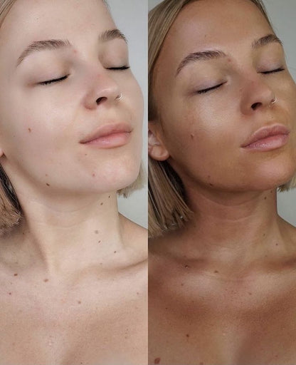 Self-Tanning Drops – Custom Natural Glow